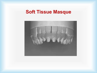 Soft Tissue Masque
 