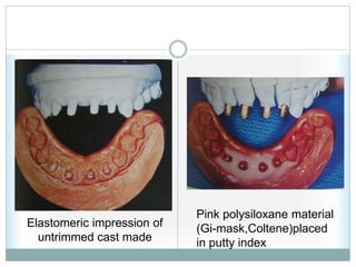 Elastomeric impression of
untrimmed cast made
Pink polysiloxane material
(Gi-mask,Coltene)placed
in putty index
 