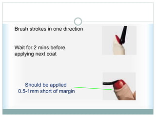 Should be applied
0.5-1mm short of margin
Brush strokes in one direction
Wait for 2 mins before
applying next coat
 