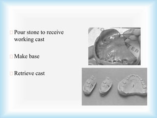 Pour stone to receive
working cast
Make base
Retrieve cast
 