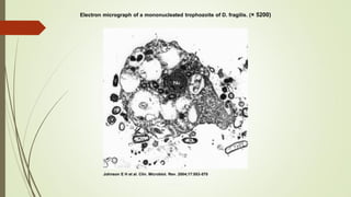 Electron micrograph of a mononucleated trophozoite of D. fragilis. (× 5200)

Johnson E H et al. Clin. Microbiol. Rev. 2004;17:553-570

 