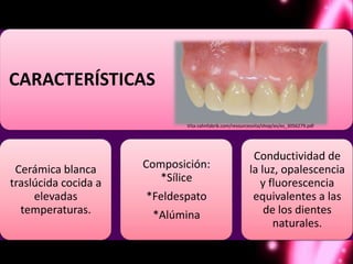 CARACTERÍSTICAS

                             Vita-zahnfabrik.com/resourcesvita/shop/es/es_3056279.pdf




                                                         Conductividad de
 Cerámica blanca      Composición:                      la luz, opalescencia
traslúcida cocida a      *Sílice                           y fluorescencia
     elevadas         *Feldespato                        equivalentes a las
  temperaturas.        *Alúmina                             de los dientes
                                                              naturales.
 