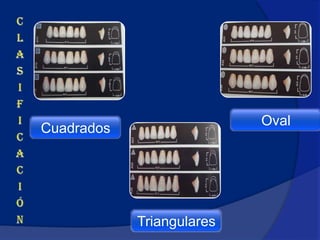 Oval
Cuadrados




            Triangulares
 
