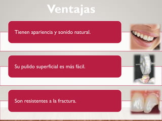 Tienen apariencia y sonido natural.
Su pulido superficial es más fácil.
Son resistentes a la fractura.
Ventajas
 
