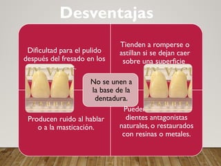 Dificultad para el pulido
después del fresado en los
dientes.
Tienden a romperse o
astillan si se dejan caer
sobre una superficie
dura.
Producen ruido al hablar
o a la masticación.
Pueden erosionar los
dientes antagonistas
naturales, o restaurados
con resinas o metales.
No se unen a
la base de la
dentadura.
Desventajas
 