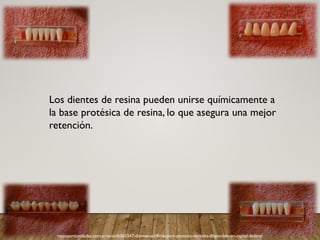 masoportunidades.com.ar/aviso/6363347-dientes-acrilicos-para-protesis-dentales-disponible-en-capital-federal
Los dientes de resina pueden unirse químicamente a
la base protésica de resina, lo que asegura una mejor
retención.
 