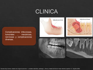 DIENTES INCLUIDOS 2025.pptx......................... | PPTX
