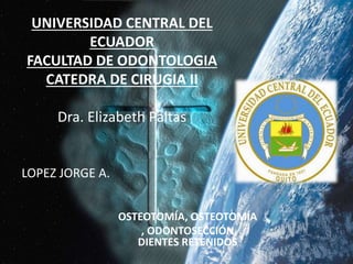 UNIVERSIDAD CENTRAL DEL
ECUADOR
FACULTAD DE ODONTOLOGIA
CATEDRA DE CIRUGIA II
Dra. Elizabeth Paltas
OSTEOTOMÍA, OSTEOTOMÍA
, ODONTOSECCIÓN
DIENTES RETENIDOS
LOPEZ JORGE A.
 