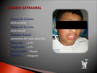 EXAMEN EXTRAORAL : Forma de Cráneo  : dolicocefalo Forma de la Cara  : dolicofacial Simetría Facial : asimetría del lado derecho Fonación : A.N.  Deglución : A.N. Respiración  : Nasal Hábitos : ninguno 