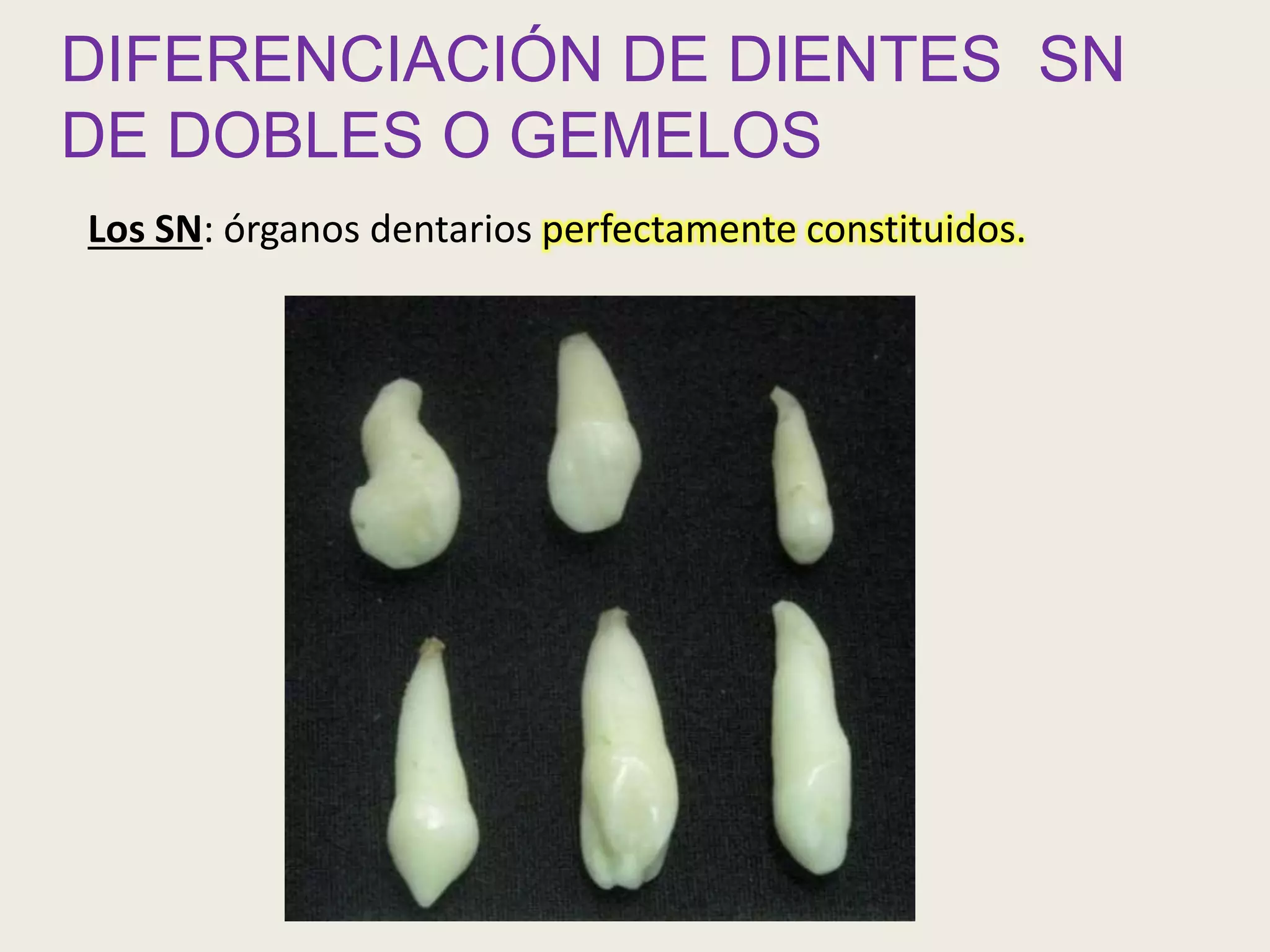 Dientes supernumerarios | PPTX | Dental Health | Diseases and Conditions