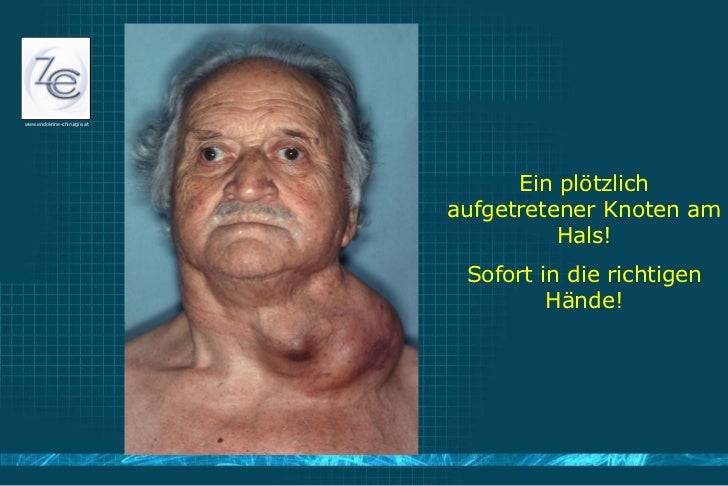 Die Schilddrüse