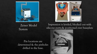 Zeiser System Comprehensive Overview of Dental Die and Die Systems in Prosthodontics ...