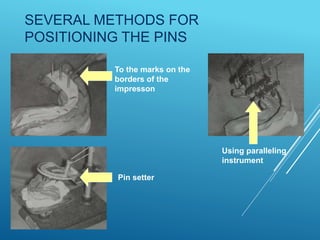 Passing Pin Instruments DIE SYSTEMS and die material in dentistry | PPTX