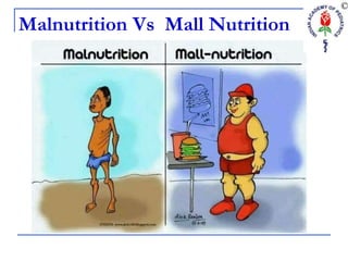 Malnutrition Vs Mall Nutrition
 