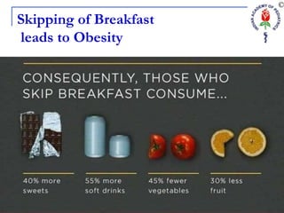 Skipping of Breakfast
leads to Obesity
 