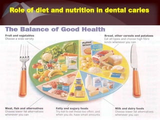 Role of diet and nutrition in dental caries
 