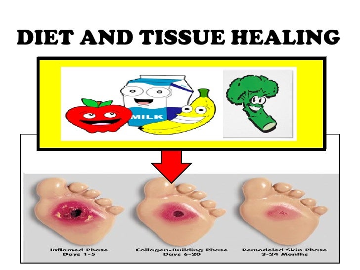 What Food To Eat Helps Heal Skin What Food To Eat Helps Heal Skin