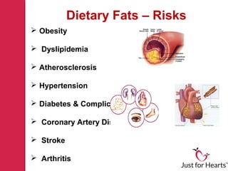 Fats Risk Dietary fats | PPT