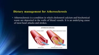 Dietary management for Atherosclerosis
• Atherosclerosis is a condition in which cholesterol calcium and biochemical
waste are deposited in the walls of blood vessels. It is an underlying cause
of most heart attacks and strokes.
 
