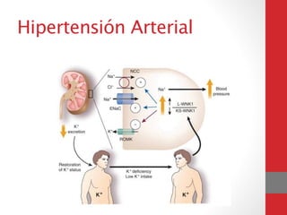 Hipertensión Arterial
 