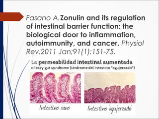 Fasano A.Zonulin and its regulation
of intestinal barrier function: the
biological door to inflammation,
autoimmunity, and cancer. Physiol
Rev.2011 Jan;91(1):151-75.
 