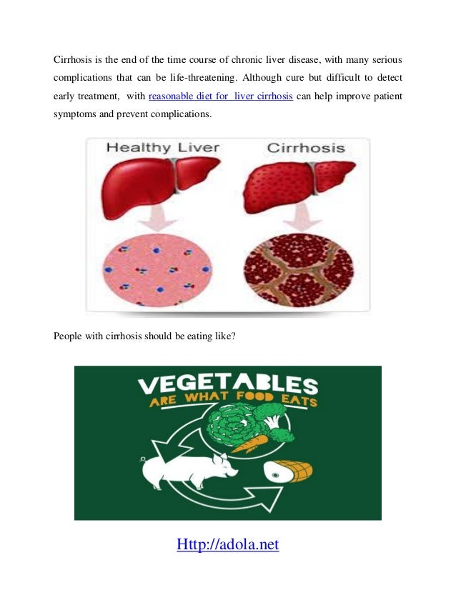  Diet Guide For Liver Cirrhosis Treatment