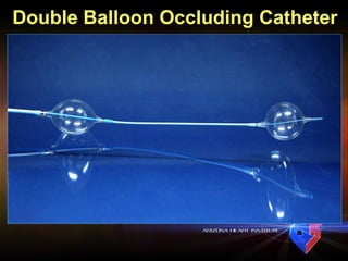 Double Balloon Occluding Catheter 