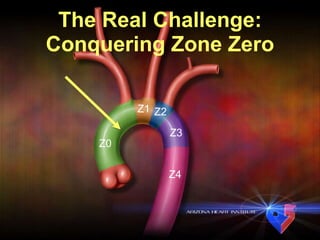 Z0 Z1 Z2 Z3 Z4 The Real Challenge: Conquering Zone Zero 