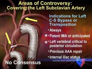 Areas of Controversy:  Covering the Left Subclavian Artery Indications for Left  C-S Bypass or Transposition Always Patent IMA or anticipated Left vertebral critical to posterior circulation Previous AAA repair Internal iliac status No Consensus * * 