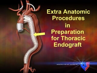 Extra Anatomic Procedures in  Preparation  for Thoracic Endograft  