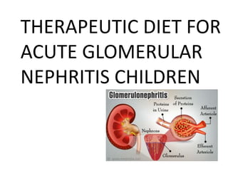 THERAPEUTIC DIET FOR
ACUTE GLOMERULAR
NEPHRITIS CHILDREN
 