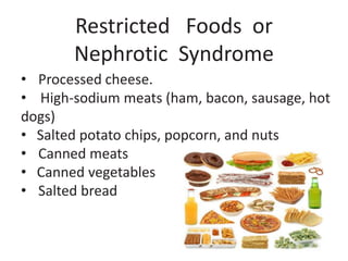 • Processed cheese.
• High-sodium meats (ham, bacon, sausage, hot
dogs)
• Salted potato chips, popcorn, and nuts
• Canned meats
• Canned vegetables
• Salted bread
Restricted Foods or
Nephrotic Syndrome
 