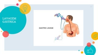 LAVAGEM
GÁSTRICA
19
 