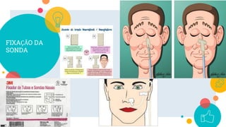 FIXAÇÃO DA
SONDA
18
 