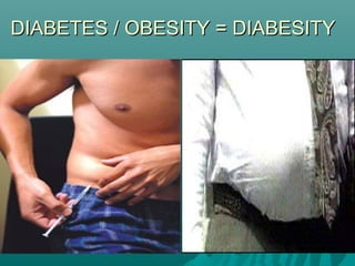 DIABETES / OBESITY = DIABESITYDIABETES / OBESITY = DIABESITY
 