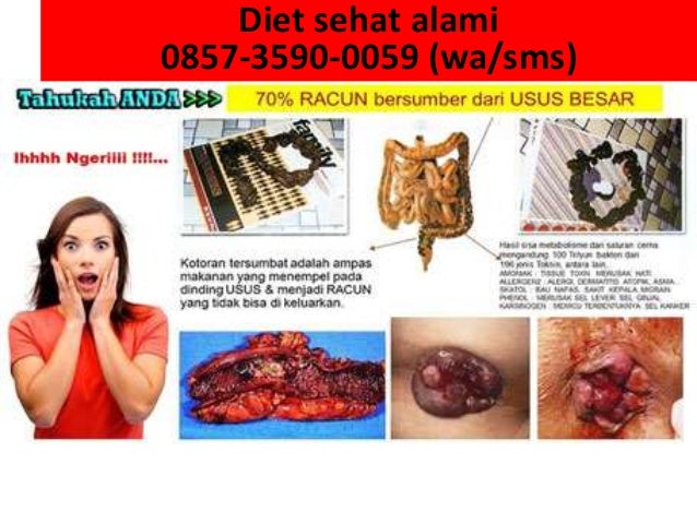  0857-3590-0059 wa sms diet sehat cepat alami