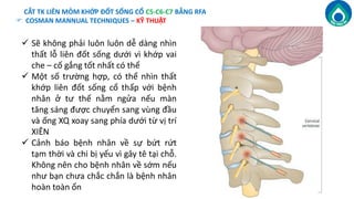 Điều Trị Đau Cột Sống Mạn Tính bằng Sóng Vô Tuyến Cao Tần RFA (Rafio ...