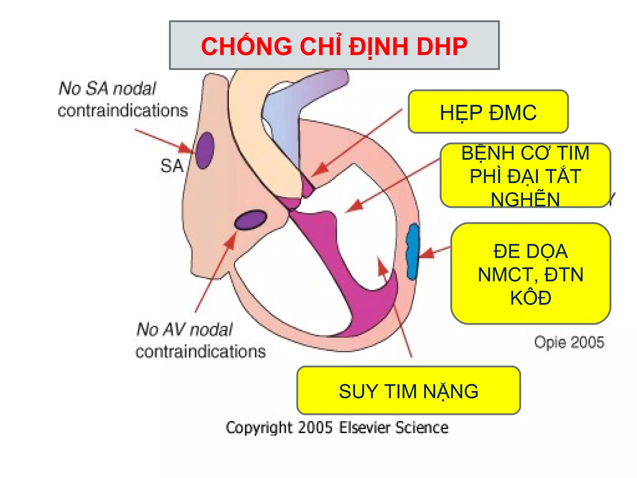 CHỐNG CHỈ ĐỊNH DHP
HẸP ĐMC
BỆNH CƠ TIM
PHÌ ĐẠI TẮT
NGHẼN
ĐE DỌA
NMCT, ĐTN
KÔĐ
SUY TIM NẶNG
 