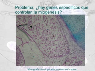 Problema: ¿hay genes específicos que controlan la miogénesis?  Micrografía de miogénesis en embrión humano 