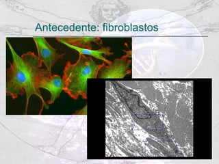 Antecedente: fibroblastos 