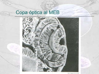 Copa óptica al MEB 