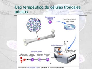 Uso terapéutico de células troncales adultas 