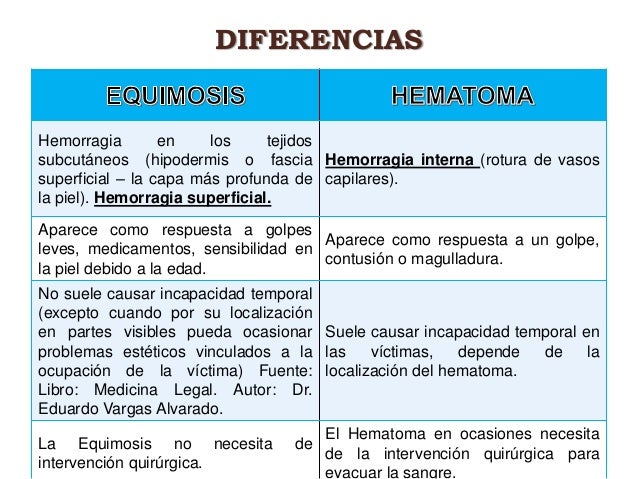 Equimosis O Hematoma