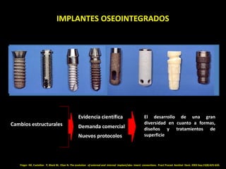 IMPLANTES OSEOINTEGRADOS
Finger IM, Castellon P, Block M, Elian N. The evolution of external and internal implant/abu- tme...