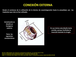CONEXIÓN EXTERNA
Binon PP. (2002) Implants and components: entering the new millennium. Int J Oral Max Impl 15: 76-91.
Son...