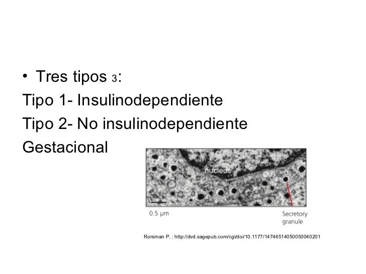 Diferentes formas de abordar el tema de diabetes Diferentes formas de abordar el tema de diabetes