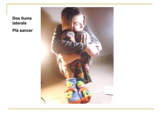 Dos llums laterals Plà sancer 