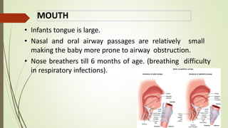 MOUTH
• Infants tongue is large.
• Nasal and oral airway passages are relatively small
making the baby more prone to airway obstruction.
• Nose breathers till 6 months of age. (breathing difficulty
in respiratory infections).
 