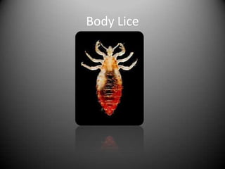 Body Lice
 