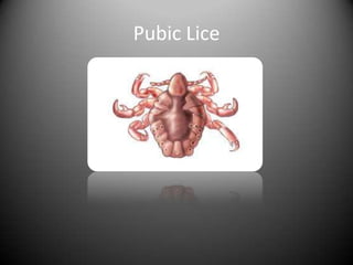 Pubic Lice
 